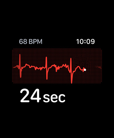 ECG app, beats per minute in top right corner, rhythm line, timer